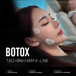 Khánh Vân Phạm - Botox gọn hàm gì chưa người đẹp ??