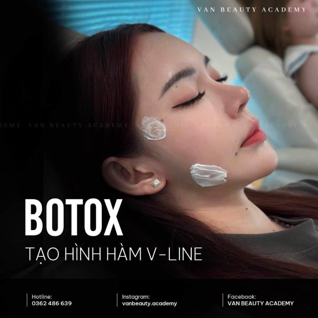 Khánh Vân Phạm - Botox gọn hàm gì chưa người đẹp ??