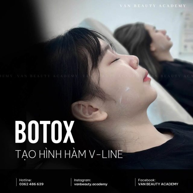 Khánh Vân Phạm - Botox gọn hàm gì chưa người đẹp ??